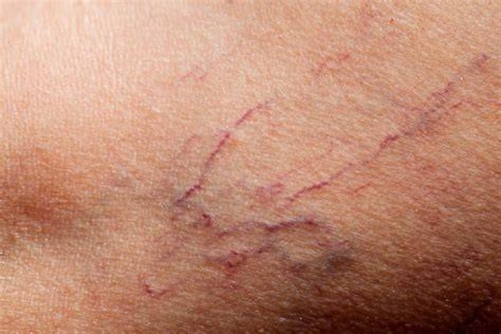 The Ultimate Hickey Masterclass: Step-by-Step Technique, Safety, and Tips