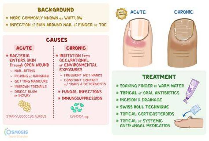 Why You Should Never Rip a Hangnail: The Hidden Danger of Sepsis and Paronychia